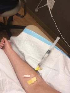 Remicade IV in my arm