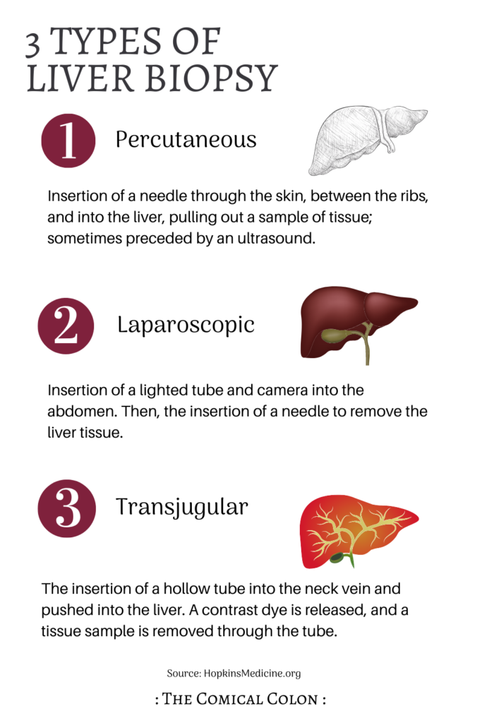 what-to-expect-at-your-ultrasound-guided-liver-biopsy