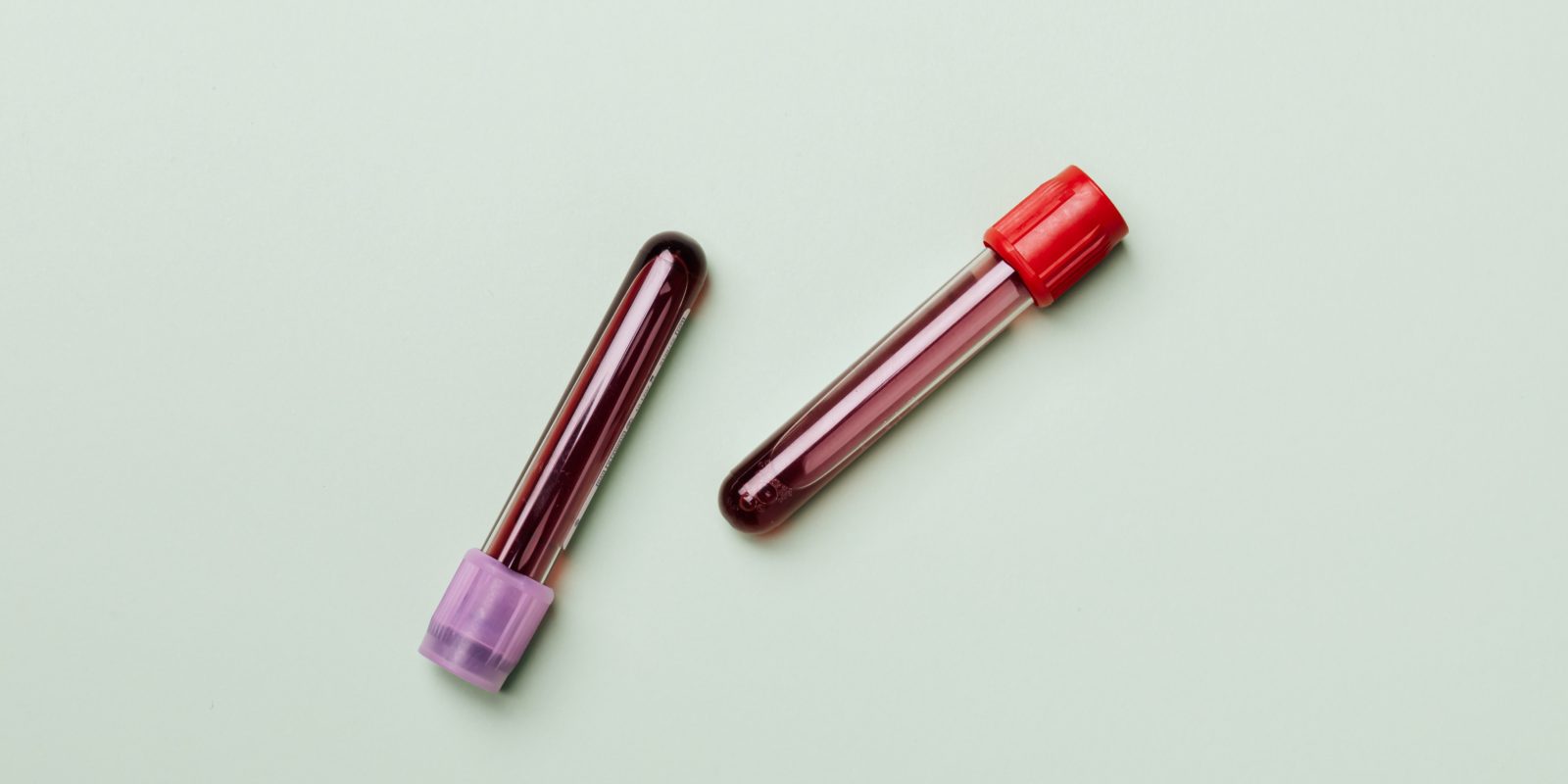 Test tubes with red and purple lids filled with blood on green background